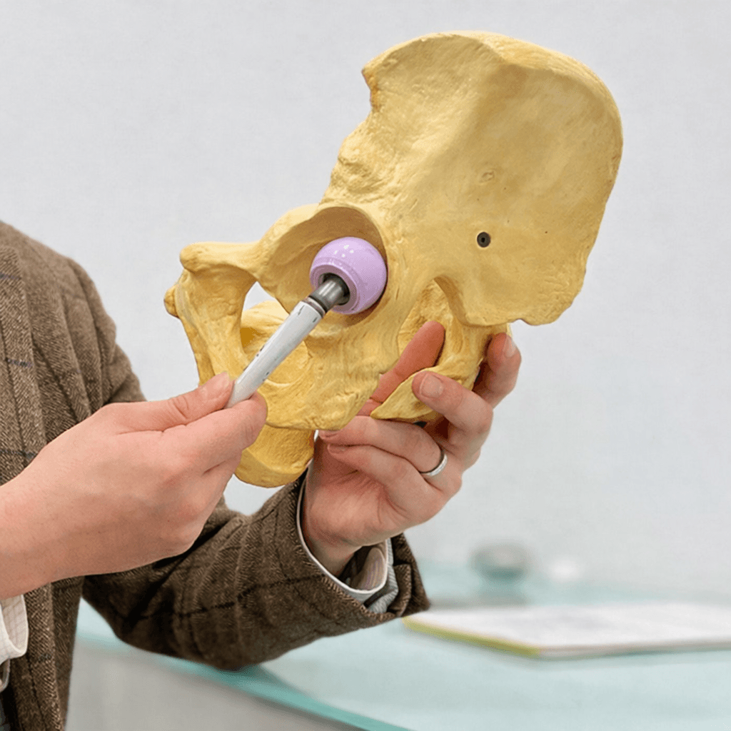 Hip replacement pelvis model